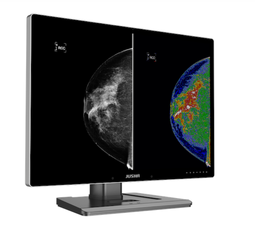 JUSHA 12MP dual-screen DICOM Diagnostic colour monitor C1210G TGA Approved